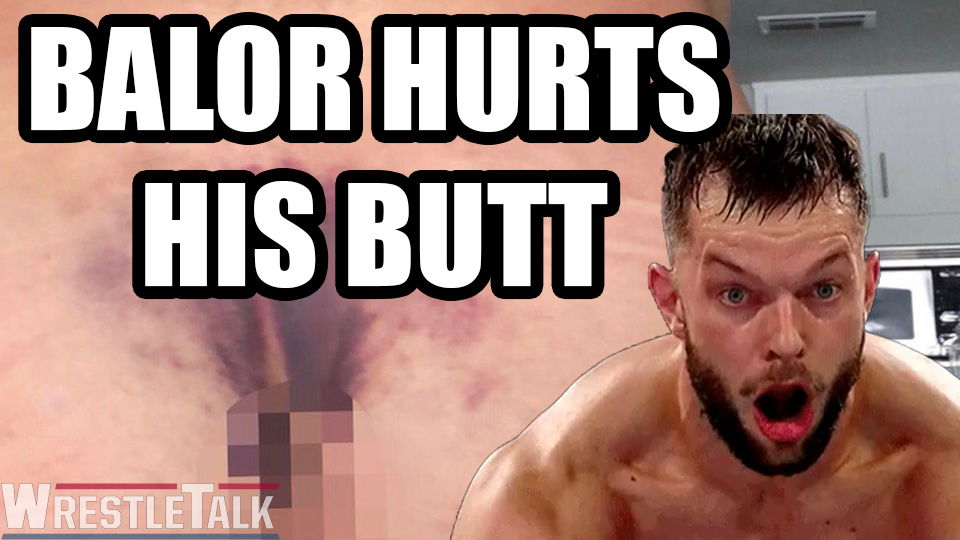 Finn Balor Hurts His BUTT