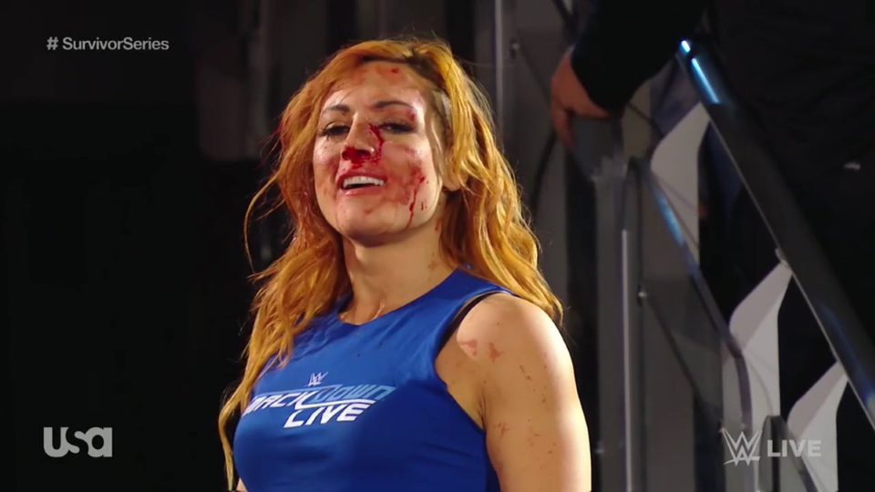 becky lynch bleeding shirt