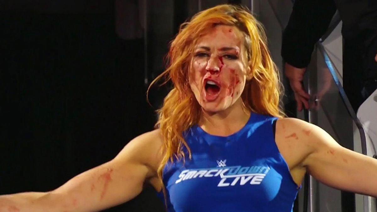 Becky Lynch Thinks Brand Supremacy At Survivor Series Is ‘A Little Outdated’