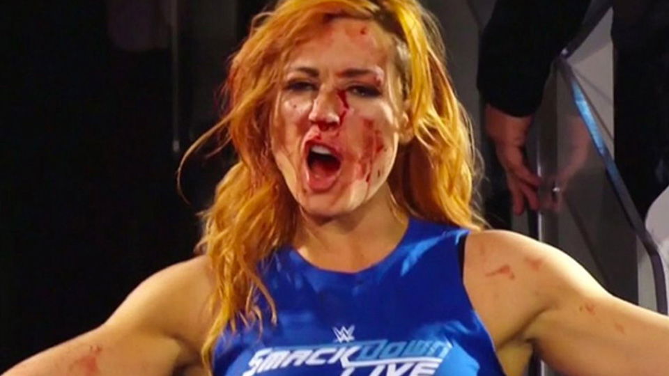 Graphic Photo Of Becky Lynch Injury After NXT No Mercy 2023 - WrestleTalk