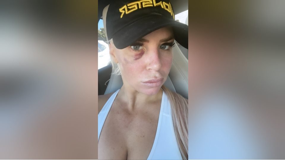 WWE Star Takes Savage Shot At Dana Brooke Black Eye Pic