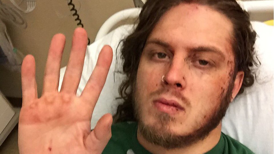 Joey Janela suffers gruesome injury (not for the faint hearted)