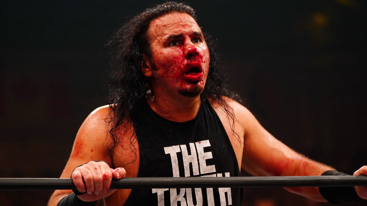 Matt Hardy Shows Off Gruesome Dynamite Injury (Photos)