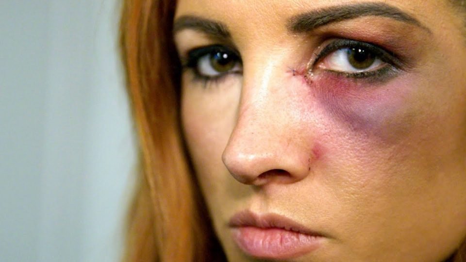 WWE Release Becky Lynch Mini-Documentary