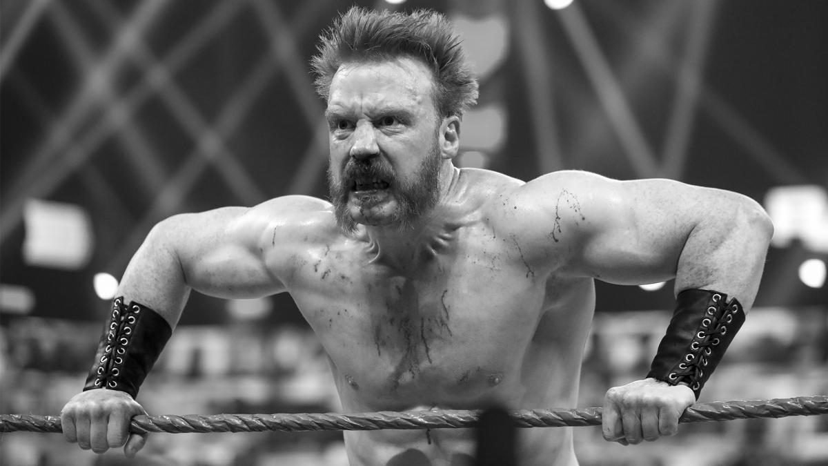 Sheamus Shows Off Gruesome Face Injury In New Hospital Photos