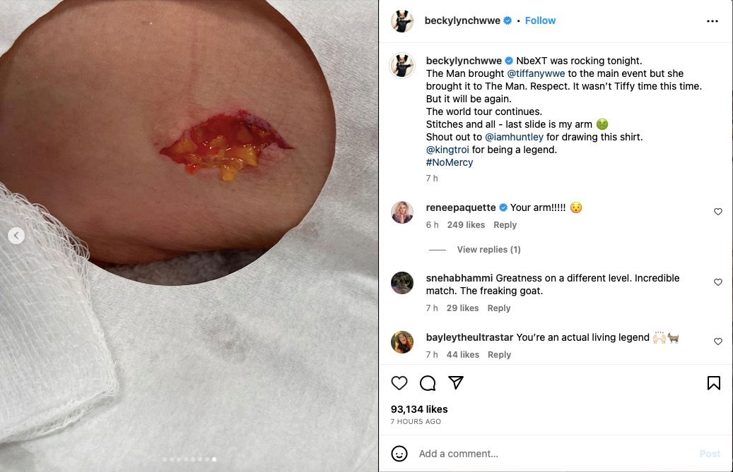 Graphic Photo Of Becky Lynch Injury After NXT No Mercy 2023 - WrestleTalk