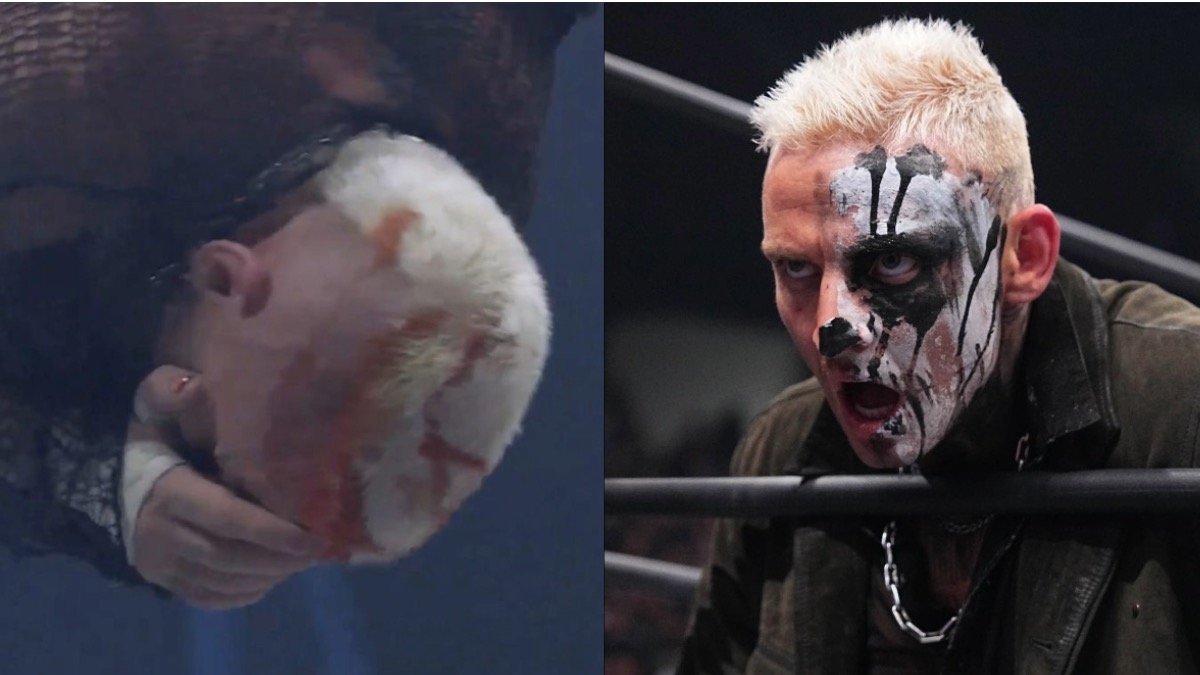 Darby Allin Shows Off Brutal Facial Injuries Following AEW Anarchy In The Arena