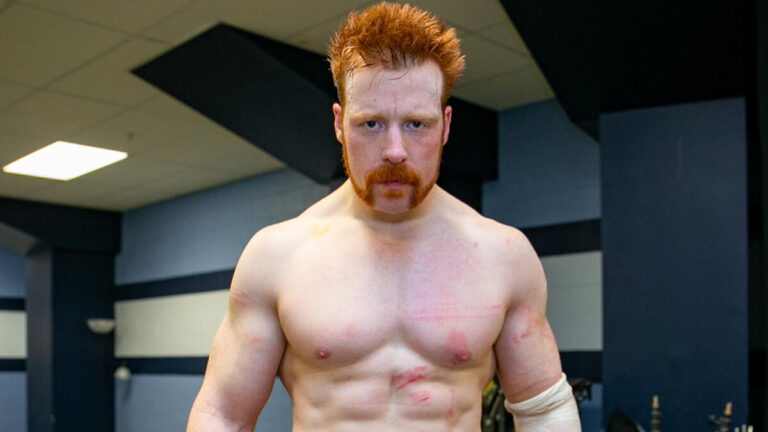 Sheamus Shows Off Wounds Following Surprise WWE Raw Attack