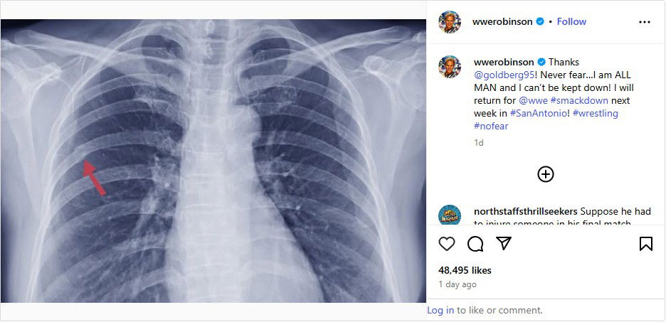 WWE referee Charles Robinson cracked rib x-ray