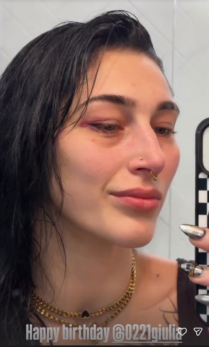 Rhea Ripley WWE Injury Update After SmackDown